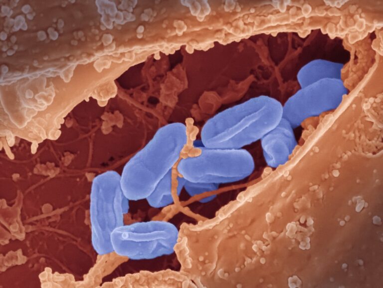 Infekcje dróg moczowych u mężczyzn – szybka ścieżka diagnostyczna i e-recepta na antybiotyk - okładka